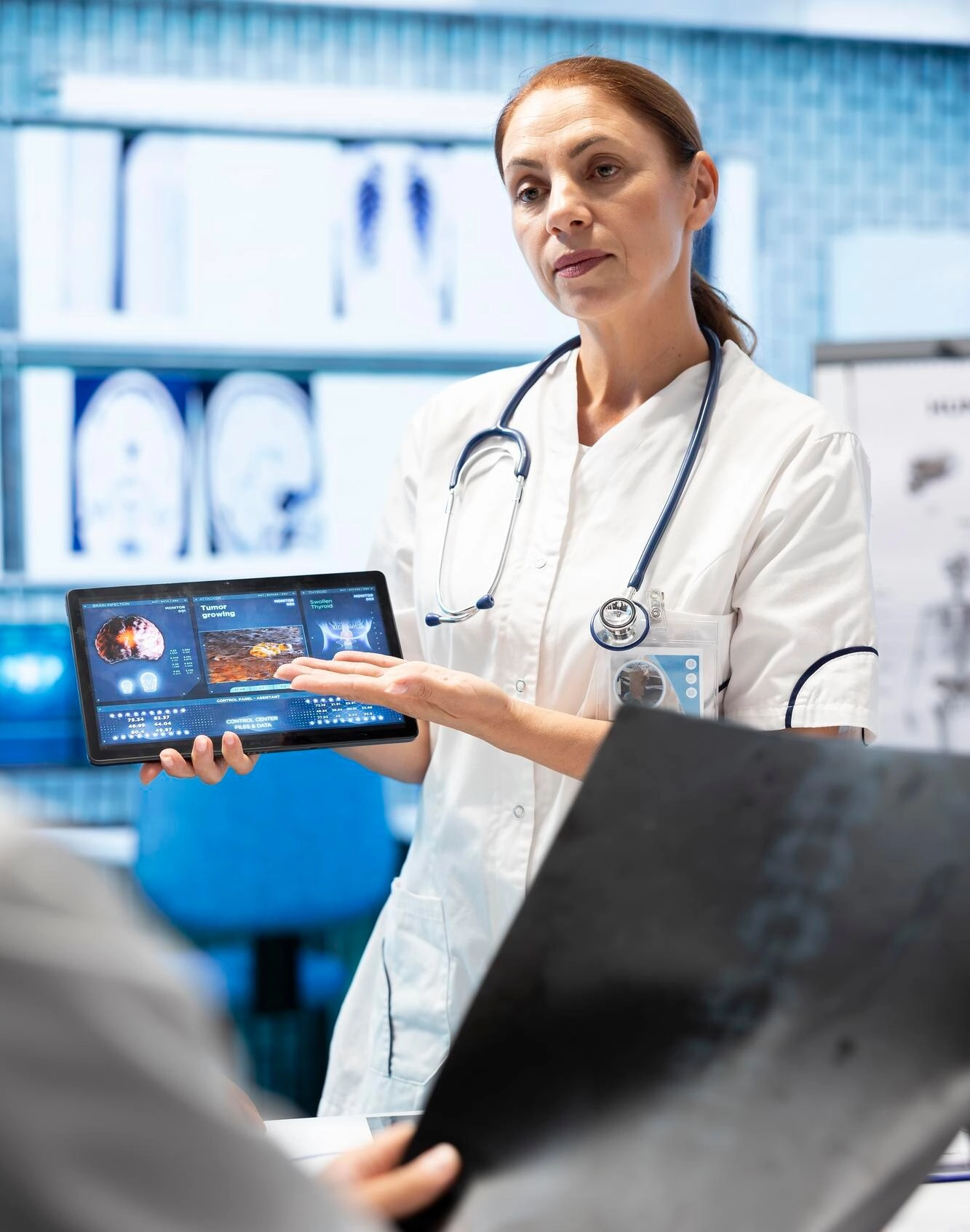 Doctor neurologist showing mri brain scan results to her colleagues-1